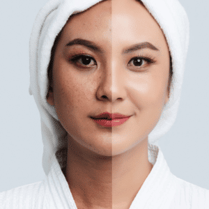 Kem Dac Tri Nam Tan Nhang Doi Moi Zo Skin Health Pigment Control Cream 4 Hq 7